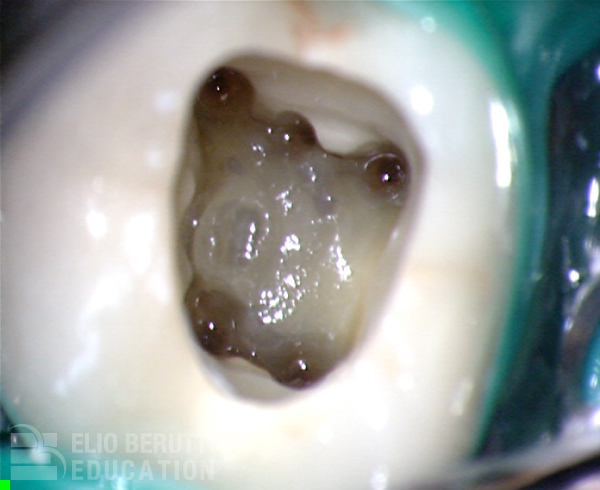 Thumbnail Image 1