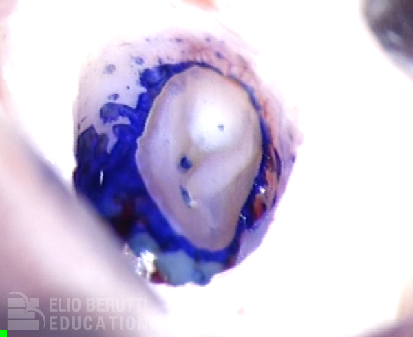 Thumbnail Image 1